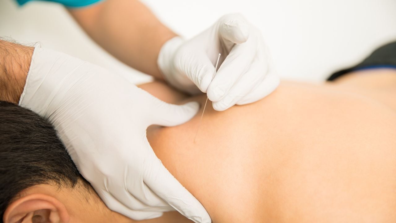 dry needling, Austin Shellnut, Athletic Edge Physical Therapy, Grovetown, GA
